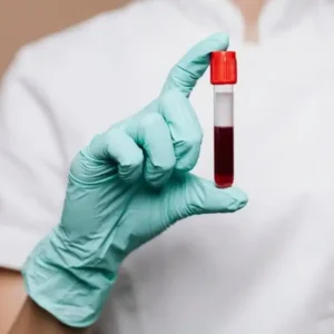 THYROID STIMULATING HORMONE (TSH)